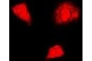 Immunofluorescent analysis of PSMA6 staining in U2OS cells. (PSMA6 anticorps)