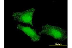 Immunofluorescence of monoclonal antibody to FOXO1 on HeLa cell.