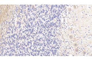 Detection of AGRN in Human Cerebellum Tissue using Polyclonal Antibody to Agrin (AGRN)