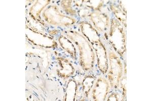Immunohistochemistry of paraffin-embedded human kidney using [KO Validated] Granulin Rabbit mAb  at dilution of 1:500 (40x lens). (Granulin anticorps)