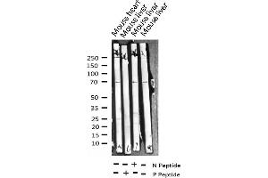 Western blot analysis of Phospho-SOX-9 (Ser181) expression in various lysates