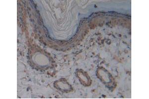 IHC-P analysis of Rat Skin Tissue, with DAB staining. (KIT anticorps)