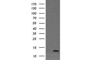 Image no. 1 for anti-D-Dopachrome Tautomerase (DDT) antibody (ABIN1497795) (DDT anticorps)
