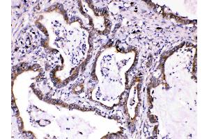 IHC analysis of Caspase8 using anti-Caspase8 antibody .