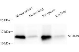 Western blot analysis of S100A9 (ABIN7075497) at dilution of 1: 800 (S100A9 anticorps)