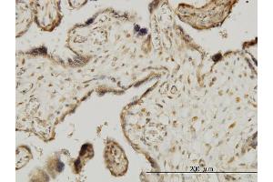 Immunoperoxidase of monoclonal antibody to MAPKAPK3 on formalin-fixed paraffin-embedded human placenta.