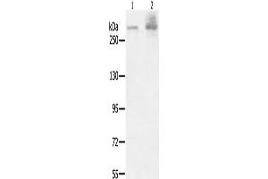 Gel: 6 % SDS-PAGE, Lysate: 40 μg, Lane 1-2: A549 cells, K562 cells, Primary antibody: ABIN7191019(HSPG2 Antibody) at dilution 1/200, Secondary antibody: Goat anti rabbit IgG at 1/8000 dilution, Exposure time: 40 seconds