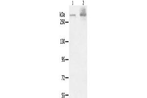 Gel: 6 % SDS-PAGE, Lysate: 40 μg, Lane 1-2: A549 cells, K562 cells, Primary antibody: ABIN7191019(HSPG2 Antibody) at dilution 1/200, Secondary antibody: Goat anti rabbit IgG at 1/8000 dilution, Exposure time: 40 seconds (HSPG2 anticorps)