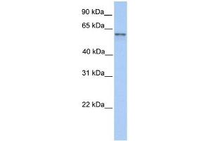 FAM13C1 antibody used at 1 ug/ml to detect target protein. (FAM13C anticorps  (N-Term))