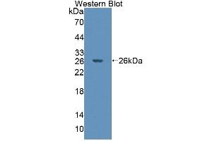 Detection of Recombinant PTPN21, Mouse using Polyclonal Antibody to Protein Tyrosine Phosphatase, Non Receptor Type 21 (PTPN21)