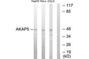Western blot analysis of extracts from HepG2/HeLa/COLO205 cells, using AKAP5 Antibody. (AKAP5 anticorps  (AA 1-50))