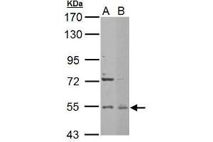 WB Image Edc3 antibody [N2C2], Internal detects EDC3 protein by Western blot analysis.
