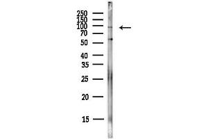 Western blot analysis of lysates from PC12 cells(LPS,4h treatment), using ICAM1 Antibody at 1/1000 dilution.
