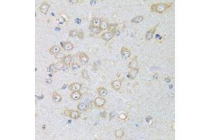 Immunohistochemistry of paraffin-embedded rat brain using CHMP1B antibody.