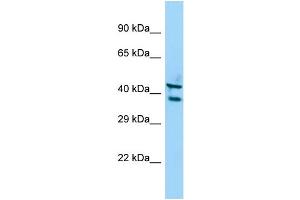 Host: Rabbit Target Name: STK35 Sample Type: A549 Whole Cell lysates Antibody Dilution: 1. (STK35 anticorps  (C-Term))
