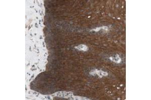 Immunohistochemical staining of human esophagus with CCDC67 polyclonal antibody  shows strong cytoplasmic positivity in squamous epithelial cells. (CCDC67 anticorps)