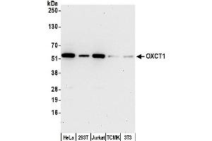 Western Blotting (WB) image for anti-3-Oxoacid CoA Transferase 1 (OXCT1) (AA 470-520) antibody (ABIN7449899)