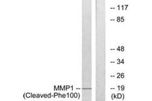 Western blot analysis of extracts from A549 cells, treated with etoposide 25uM 24h, using MMP1 (Cleaved-Phe100) Antibody. (MMP1 anticorps  (Cleaved-Phe100))