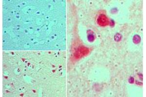 Image no. 2 for anti-ArfGAP with GTPase Domain, Ankyrin Repeat and PH Domain 2 (AGAP2) (AA 450-500) antibody (ABIN960074)