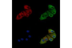 Phospho-Stathmin 1 (Ser63) Antibody staining Hela cells(heat shock treatment) by IF/ICC.