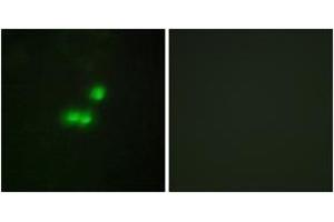 Immunofluorescence analysis of MCF7 cells, using TF3B Antibody. (BRF1 anticorps  (AA 231-280))
