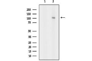 Western blot analysis of lysates from MCF7, using ADAMTS1 Antibody.
