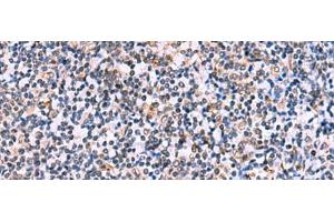 Immunohistochemistry of paraffin-embedded Human tonsil tissue using NMRK2 Polyclonal Antibody at dilution of 1:55(x200) (ITGB1BP3 anticorps)