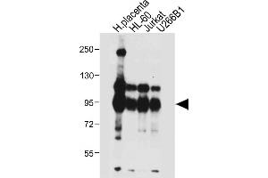 All lanes : Anti-NLRP6 Antibody (N-term) at 1:4000 dilution Lane 1: Human placenta tissue lysate Lane 2: HL-60 whole cell lysate Lane 3: Jurkat whole cell lysate Lane 4: U266B1 whole cell lysate Lysates/proteins at 20 μg per lane. (NLRP6 anticorps  (N-Term))