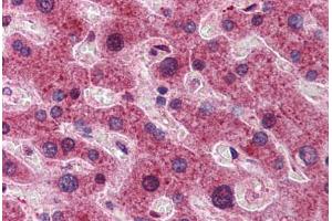 Human Liver: Formalin-Fixed, Paraffin-Embedded (FFPE)