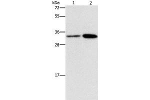 Western Blot analysis of Hela and A431 cell using CDC34 Polyclonal Antibody at dilution of 1:900 (CDC34 anticorps)