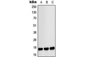 Western blot analysis of MYL9 (pS18) expression in LO2 EGF-treated (A), Raw264.