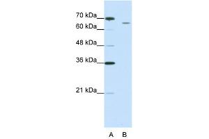 WB Suggested Anti-CPSF3 Antibody Titration:  1. (CPSF3 anticorps  (C-Term))