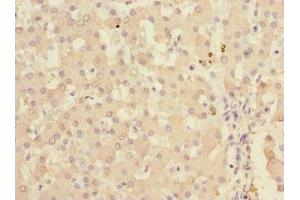 Immunohistochemistry of paraffin-embedded human liver tissue using ABIN7157477 at dilution of 1:100