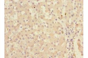Immunohistochemistry of paraffin-embedded human liver tissue using ABIN7157477 at dilution of 1:100 (Ketohexokinase anticorps  (AA 1-298))