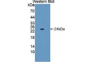Western blot analysis of the recombinant protein. (FTL anticorps  (AA 2-175))