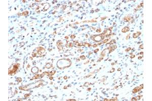 Formalin-fixed, paraffin-embedded human Liver stained with HSP60 Rabbit Recombinant Monoclonal Antibody (HSPD1/2206R). (Recombinant HSPD1 anticorps)
