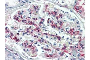 Human Kidney: Formalin-Fixed, Paraffin-Embedded (FFPE) (METTL7B anticorps  (C-Term))