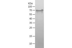 Microtubule-Associated Protein tau (MAPT) (AA 1-441) protein (His tag)
