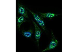Immunofluorescence analysis of HepG2 cells using INCENP antibody (green). (INCENP anticorps  (AA 369-583))