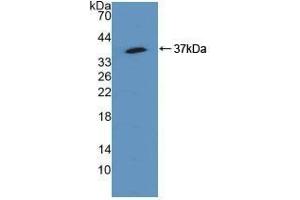 Detection of Recombinant SQSTM1, Human using Polyclonal Antibody to Sequestosome 1 (SQSTM1) (SQSTM1 anticorps  (AA 136-400))