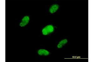 Immunofluorescence of purified MaxPab antibody to ZNF446 on HepG2 cell. (ZNF446 anticorps  (AA 1-450))