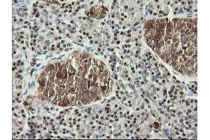 Image no. 5 for anti-Musashi Homolog 1 (Drosophila) (MSI1) antibody (ABIN1499571)