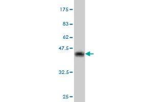 Western Blot detection against Immunogen (36. (CRYBB1 anticorps  (AA 37-137))