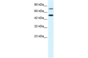 Western Blotting (WB) image for anti-Choroideremia-Like (Rab Escort Protein 2) (CHML) antibody (ABIN2463728) (CHML anticorps)