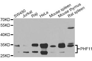 Western blot analysis of extracts of various cell lines, using PHF11 Antibody (ABIN5975729) at 1/1000 dilution. (PHF11 anticorps)