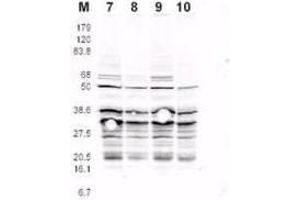 This product was assayed by western blotting against RFA2 containing cell lysates. (RPA2 anticorps  (pSer122))