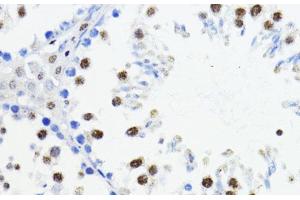 Immunohistochemistry of paraffin-embedded Mouse testis using ZEB1 Polyclonal Antibody at dilution of 1:200 (40x lens).