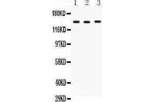 Anti- ACE antibody,  Western blotting All lanes: Anti Angiotensin Converting Enzyme 1 () at 0.