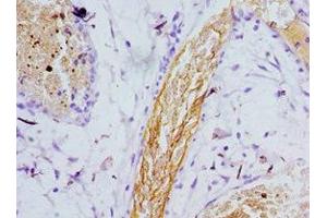 Immunohistochemistry of paraffin-embedded human epityphlon tissue using ABIN7164263 at dilution of 1:100 (Presenilin 1 anticorps  (AA 1-160))