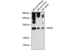 Western blot analysis of extracts of various cell lines, using RNF4 antibody (ABIN6129121, ABIN6147041, ABIN6147042 and ABIN6215602) at 1:3000 dilution. (RNF4 anticorps  (AA 1-190))